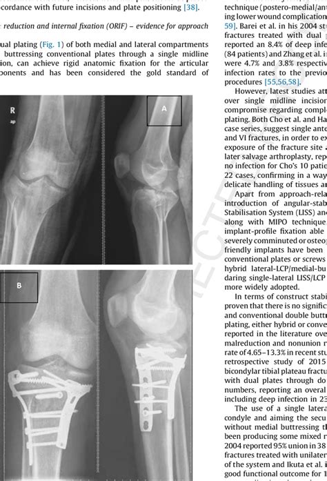 A 31 Year Old Male With A Displaced Bicondylar Tibial Plateau Fracture