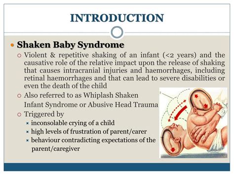 Ppt Shaken Baby Syndrome Powerpoint Presentation Free Download Id