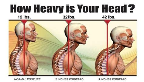 Your Neck Pain How To Know If It Is It Due To Aging Or Posture