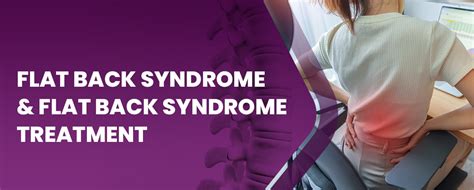Flat Back Syndrome And Flat Back Syndrome Treatment