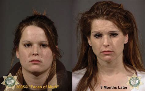 horrifying before and after photos of meth users mother jones