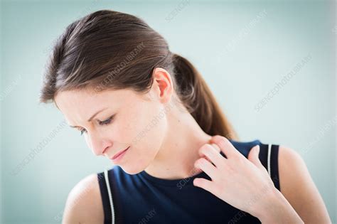 Woman Scratching Her Neck Stock Image C0346375 Science Photo Library