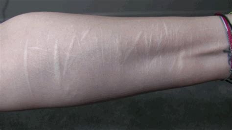 Extreme Arm Scars Wmv Cassandra Calogera S Fetish Store Clips Sale