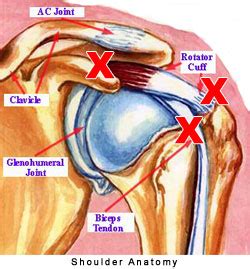 The shoulder is a complex combination of bones and joints where many muscles act to provide the widest range of motion of any part of the body. Shoulder Tendonitis Information - iTendonitis.com
