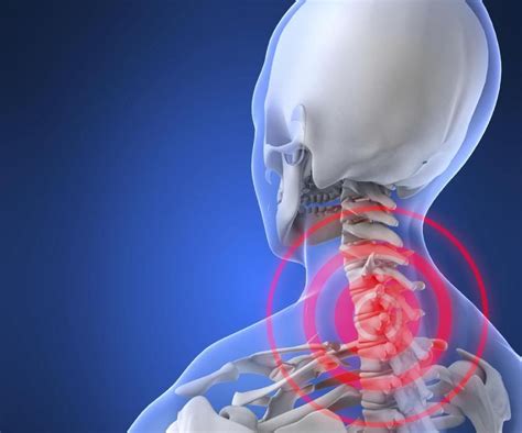 Secrets To Neck Pain Relief Physical Therapy In Houston Tx