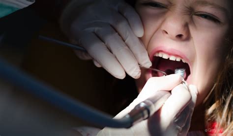 Your Top 13 Scariest Dental Horror Stories Practice Management