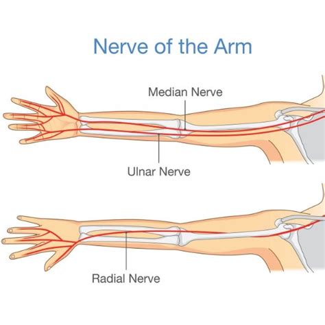 Radial Nerve Compression Elbow Specialist South Windsor Enfield