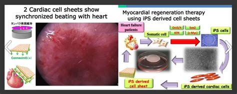 Japan Conditionally Approves New Ips Cell Based Heart Study The Niche