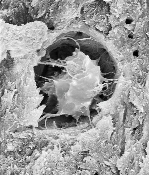 Bone Cell In Compact Bone Photograph By Dennis Kunkel Microscopy