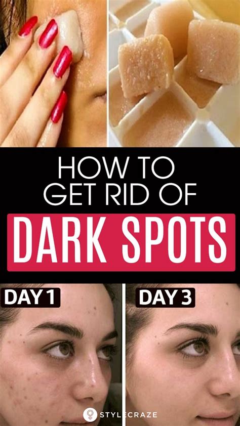 how to remove dark spots on face fast 6 home remedies acne dark spots dark spots on skin