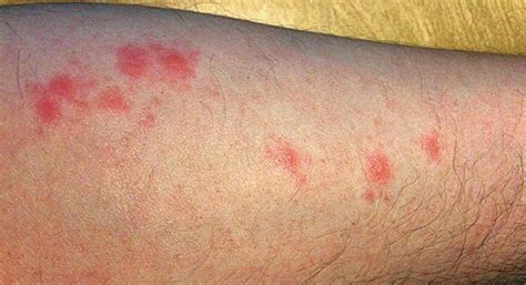 We did not find results for: Zwalczanie pluskwy domowej - Insektpol