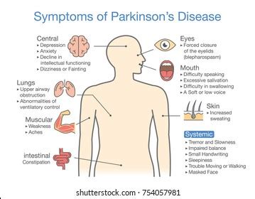 They may also have mental and behavioral changes. Parkinson Images, Stock Photos & Vectors | Shutterstock