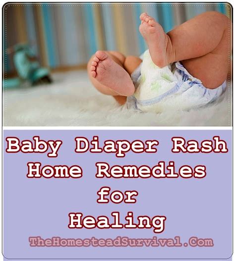 Baby Diaper Rash Home Remedies For Healing The Homestead Survival