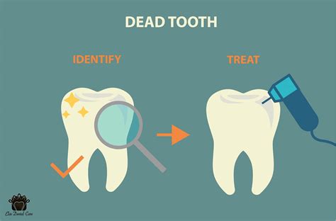 identifying and treating a dead tooth elite dental care tracy