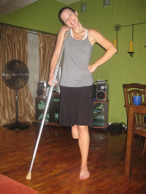 One Leg Amputee Woman Crutches Foto