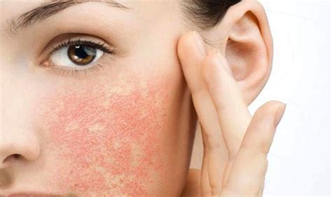 An allergic reaction is an inflammatory process that is triggered by a foreign substance known as an allergen. How does makeup affect your skin when using them ...