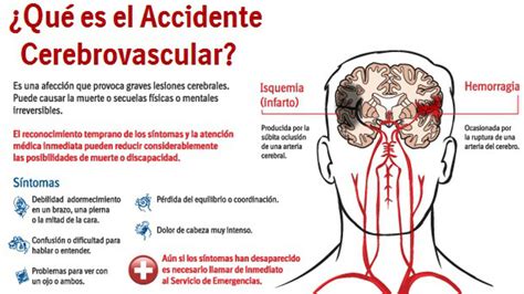 ACV prevenir y estar atentos a las señales marca la diferencia entre