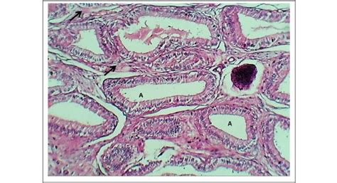 Section Of Mucosal Alveoli Of Vesicular Gland In Domestic Bull Shows