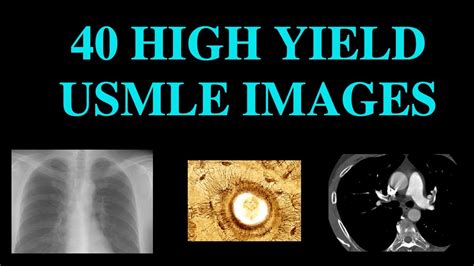 40 High Yield Images For Usmle Ct Xray Histology Youtube