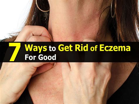 7 Ways To Get Rid Of Eczema For Good