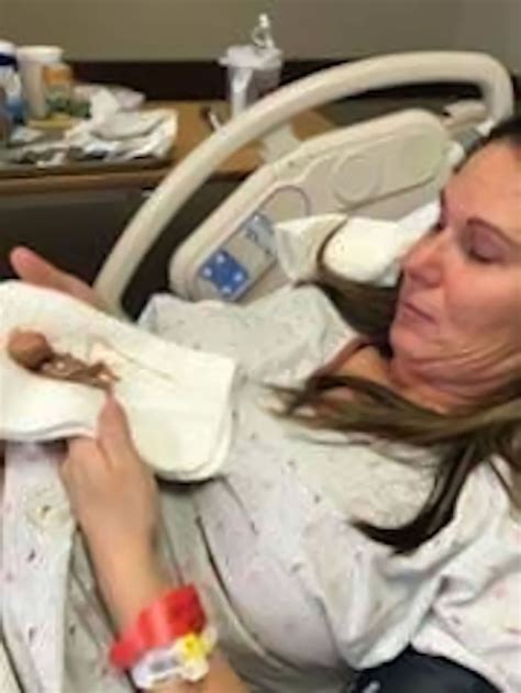 Photos Of ‘perfectly Formed 14 Week Miscarried Baby Are Saving Lives