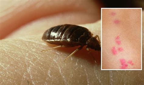 Bed Bug Bites The Specific Cluster Of Bites That Means Youve Been