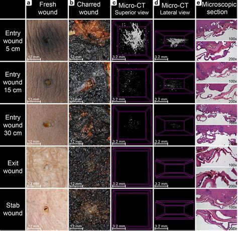 A Macroscopic Pictures Of Fresh Wounds The Entrance Gunshot Lesions