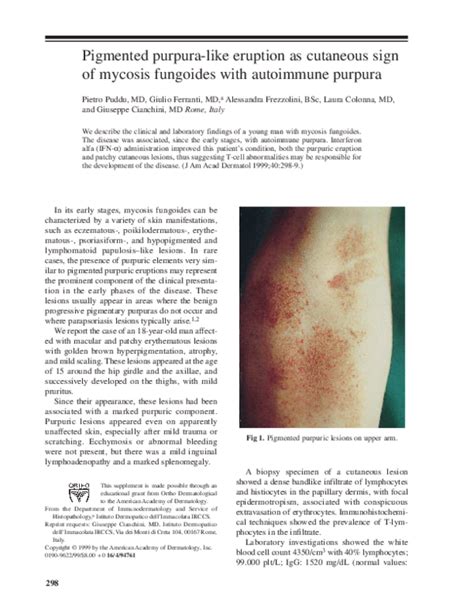 Pdf Pigmented Purpura Like Eruption As Cutaneous Sign Of Mycosis