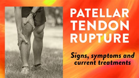 Patellar Tendon Rupture Signs Symptoms And Current Treatments Dr Geier