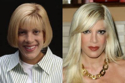 Tori Spelling With Images Celebrity Plastic Surgery Nose Job Actress Without Makeup