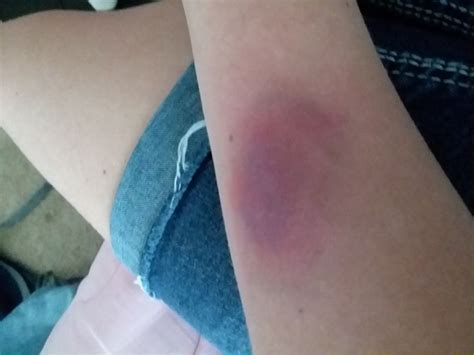 How To Make A Fake Bruise Using Halloween Makeup Gails Blog