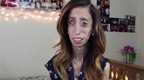 Worlds Ugliest Woman Faces Up To Online Bullies In Anti Bullying