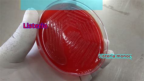 Listeria monocytogenes is one of the most virulent foodborne zoonotic pathogen with 20 to 30%. Listeria on blood agar - YouTube