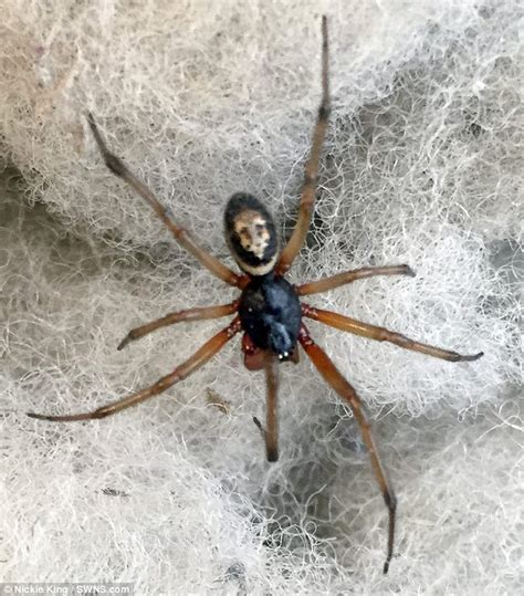 The poison means the bite will swell a little and be painful, but the pain should subside after about 12 hours. False widow spider bite leaves lorry driver with gaping ...