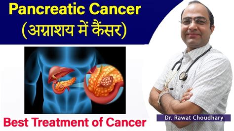 Pancreatic Cancer Treatment अग्नाशय में कैंसर का इलाज Homeopathic