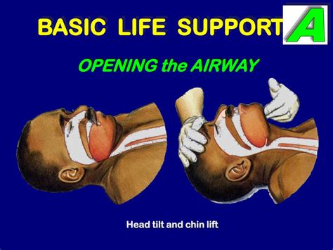 Ppt Basic Life Support Powerpoint Presentation Free Download Id