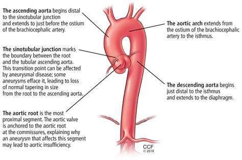 Thoracic Aortic Aneurysm How To Counsel When To Refer Cleveland