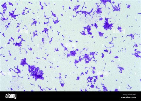 Streptococcus Pyogenes Bacterium Stock Photo Alamy