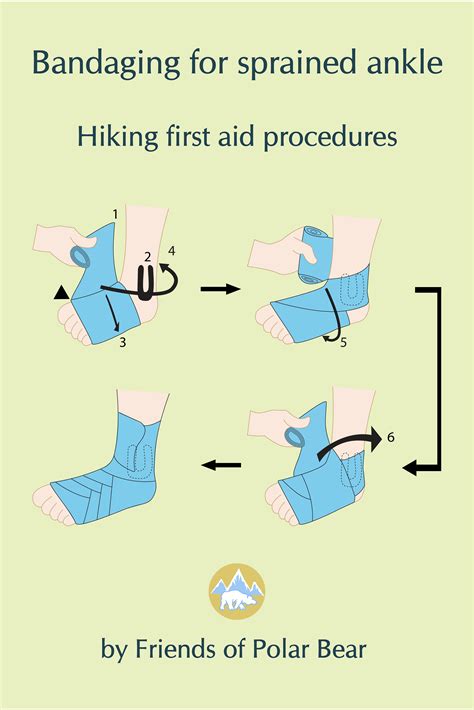 First Aid Ankle Bandaging Sprained Ankle First Aid Treatment Ankle