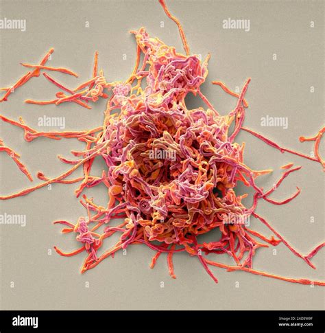 Mycoplasma Pneumoniae Coloured Scanning Electron Micrograph Sem Of