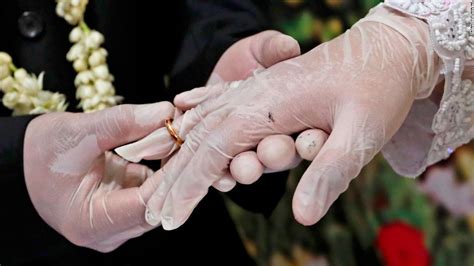 Https://tommynaija.com/wedding/is Using Wedding Ring As Cock Ring Safe