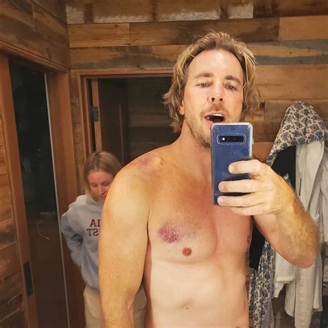 Dax Shepard Needs Surgery After Breaking Multiple Ribs In Motorcycle