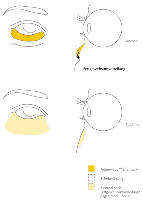 Habe eine sehr gute erfahrungen gemacht mit dr. Augenlidstraffung beim Facharzt in Freiburg | BORGES ...