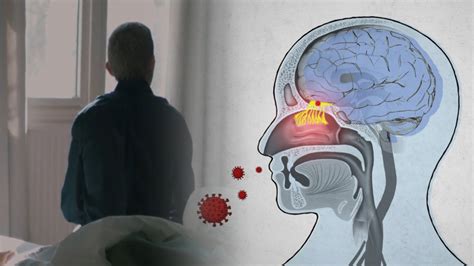 Wsj Explains The Science Behind How The Coronavirus Affects The Brain