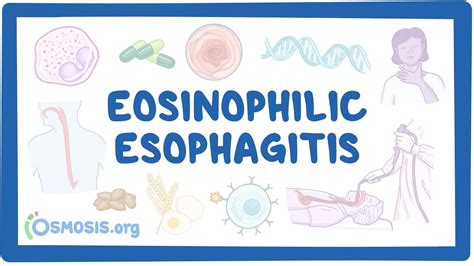 Eosinophilic Esophagitis Nord Youtube