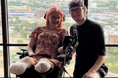 Woman Loses All Four Limbs After Catching Disease From Concerts Mist