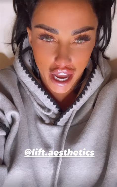 katie price reveals fresh jiggling bum after getting more fillers metro news
