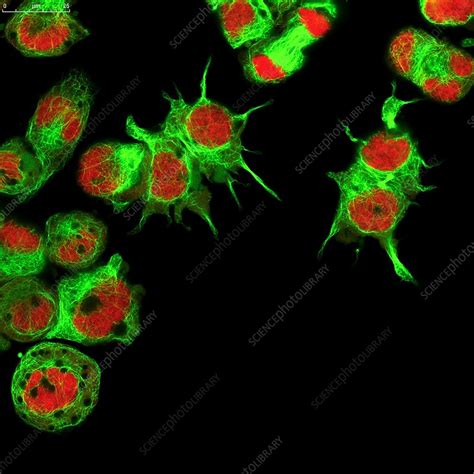 Neuroblastoma Cells Fluorescence Light Micrograph Stock Image C034