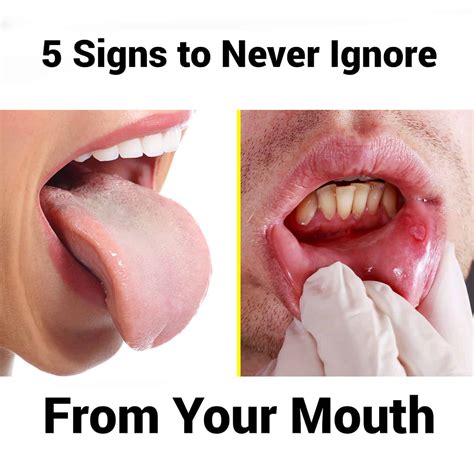 5 Signs To Never Ignore From Your Mouth