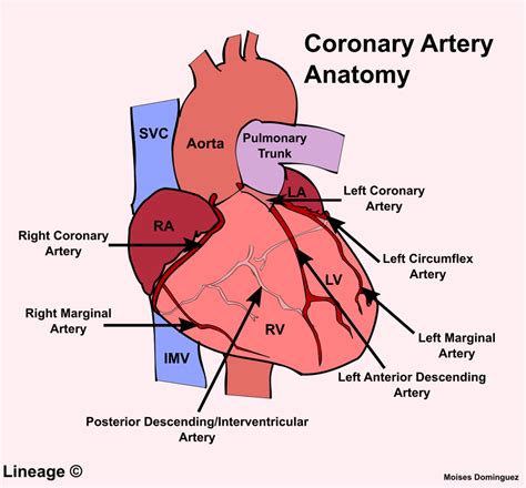Printable Coronary Artery Diagram
